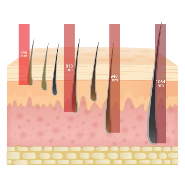 Lasermaskin för skönhetsklinik, diode laser, alexandrite, yag laser